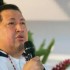 Hugo Chávez Dice Que El Cáncer Lo Ha Hecho Más Cristiano solo para ti radio Hugo Chávez Dice Que El Cáncer Lo Ha Hecho Más Cristiano solo para ti radio